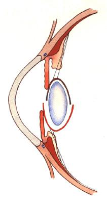 Ciliary Body, Ciliary Muscle